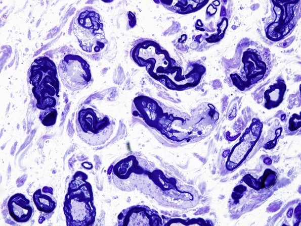 16A5 Artifact, wrist nerve Plastic 3.jpg