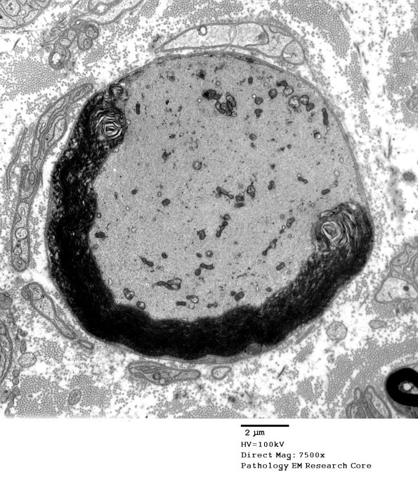 16B2 Artifact EM_023 - Copy