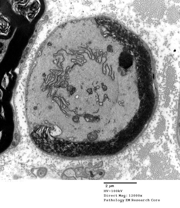 16B4 Artifact EM_036 - Copy