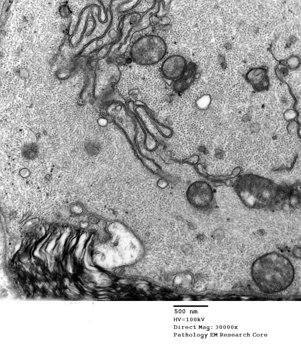 16B5 Artifact EM_037 - Copy