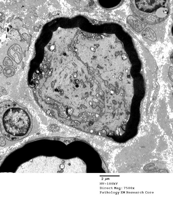 16C1 Artifact, crush EM 020 - Copy