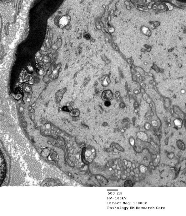 16C2 Artifact, crush EM 032 - Copy