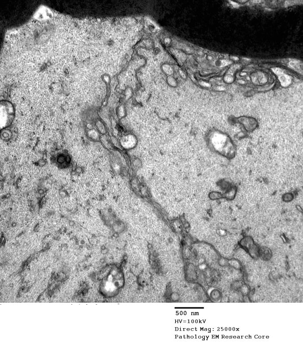 16C3 Artifact, crush EM 034 - Copy