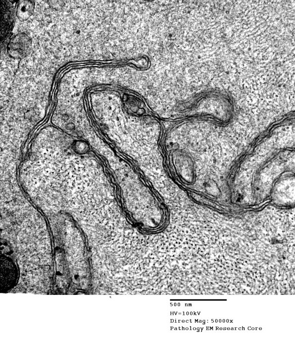 16D2 Axonal Degeneration EM 020 - Copy
