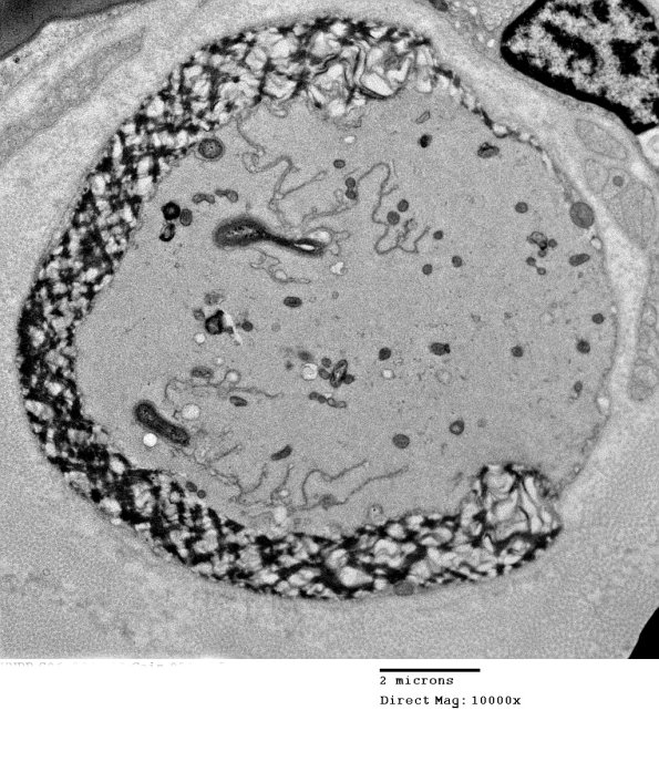 16E1 HNPP EM_058 - Copy