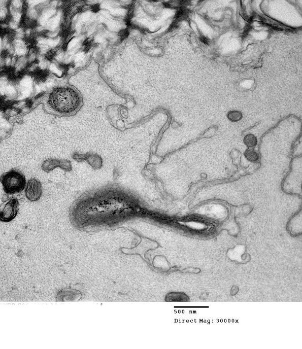 16E2 HNPP EM_061 - Copy