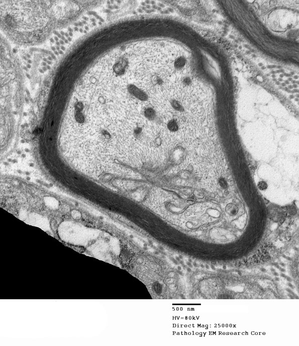 16F2 Axonal Degeneration, Honeycomb Pattern (S89-13479) 033 - Copy