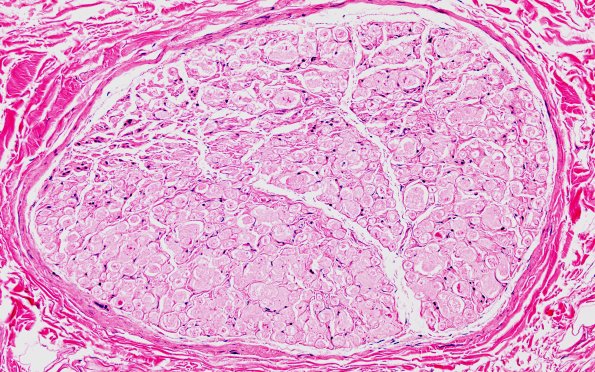 17C2 Artifact, vesicular myelin, 6 days unfixed on wet gauze H&E 20X 1