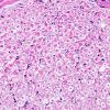17C3 Artifact, vesicular myelin, 6 days unfixed on wet gauze H&E 40X 1