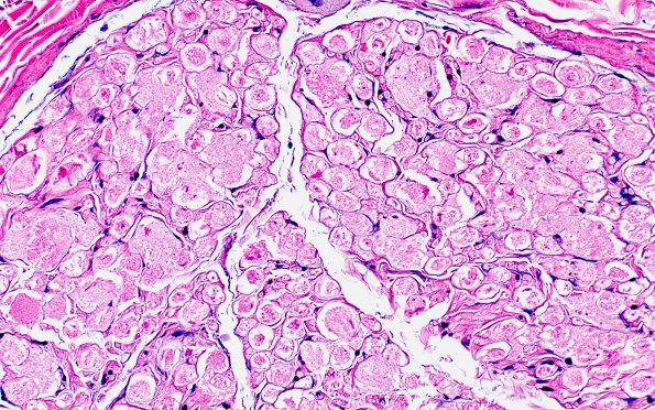 17C4 Artifact, vesicular myelin, 6 days unfixed on wet gauze H&E 40X 3