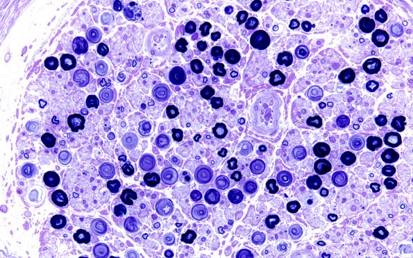 18A2 Artifact, crush Plastic 3 (60X)