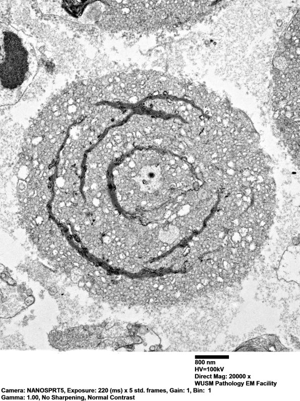 19A4 nerve_021 - Copy