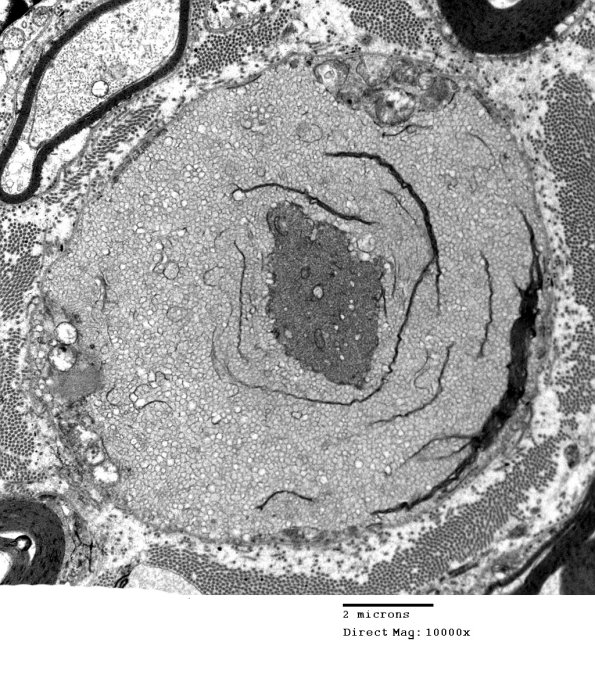 19B10 Artifact, vesicular myelin EM 062 - Copy