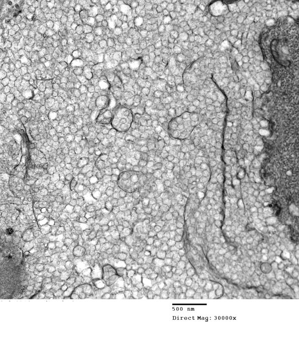 19B11 Artifact, vesicular myelin EM 068 - Copy