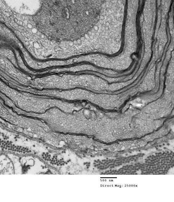 19B2 Artifact, vesicular myelin EM 035 - Copy