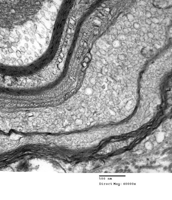 19B3 Artifact, vesicular myelin EM 032 - Copy