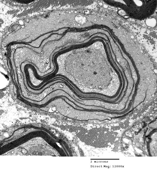 19B4 Artifact, vesicular myelin EM 036 - Copy