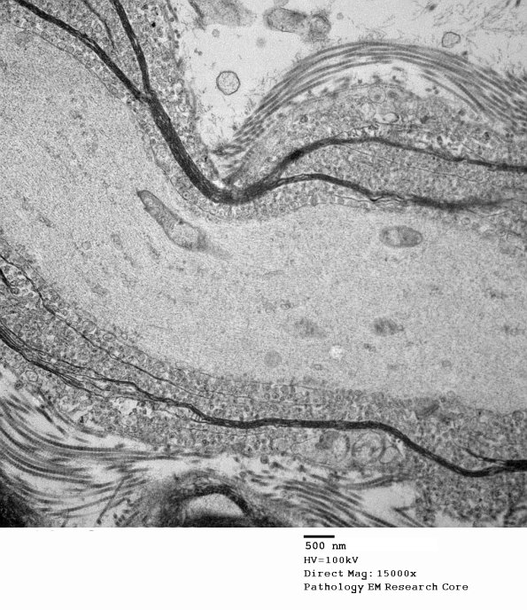 19C2 Artifact, vesicular myelin, spinal root EM 023A - Copy