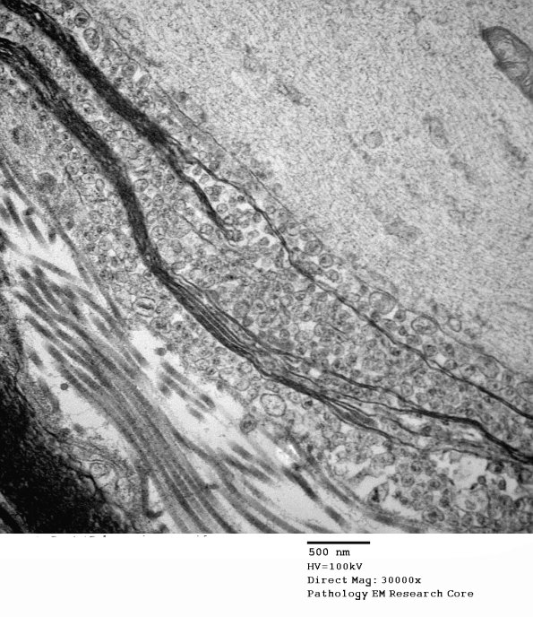 19C3 Artifact, vesicular myelin, spinal root EM 025A - Copy
