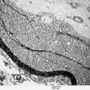 19C6 Artifact, vesicular myelin, spinal root EM 034A - Copy
