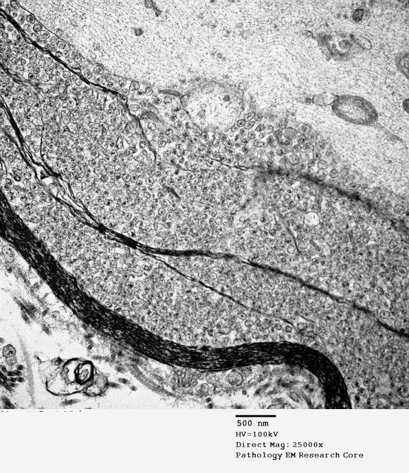 19C6 Artifact, vesicular myelin, spinal root EM 034A - Copy