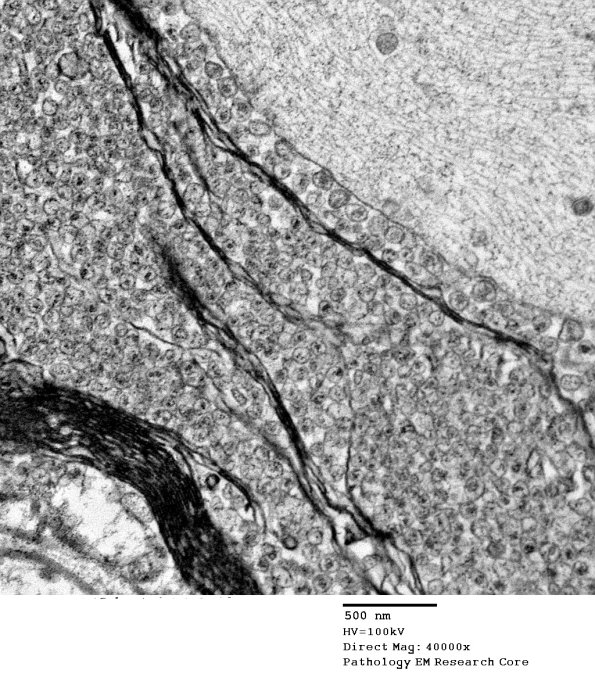 19C7 Artifact, vesicular myelin, spinal root EM 035A - Copy