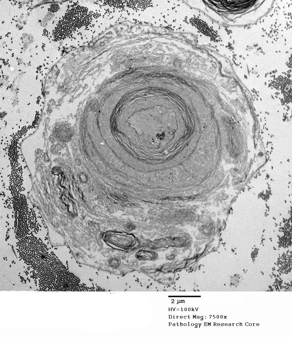 19E1 Artifact, myelin EM 005 - Copy