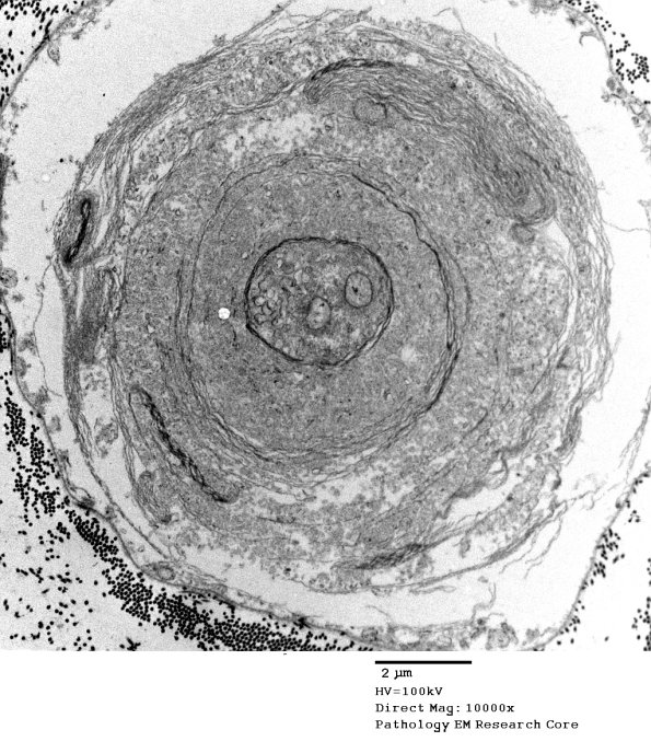 19E2 Artifact, myelin EM 020 - Copy