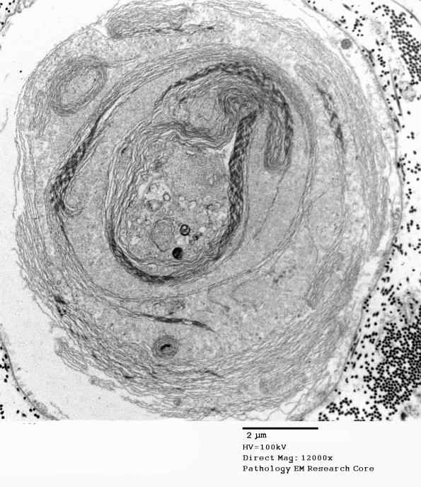 19E3 Artifact, myelin EM 032 - Copy