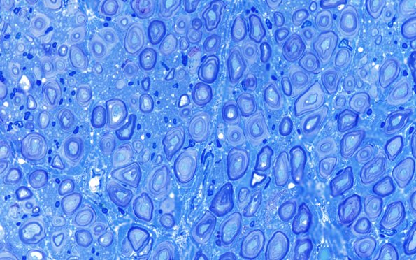 20D3 (Case 20) 100X 2