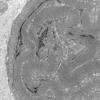 21A3-Case-21-Muscle_053.jpg