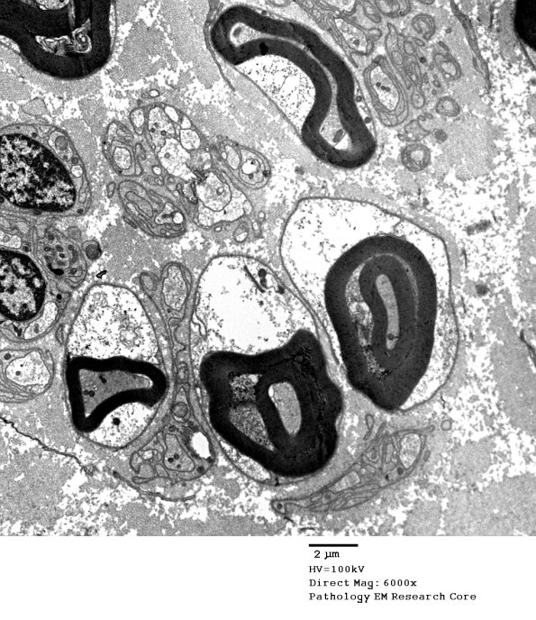 4A Artifact, Schwann cells EM 014 - Copy