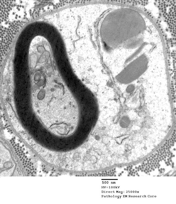 4B1 Axonal artifact EM 052 - Copy