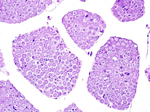 5E Neurokeratin artifact (Monkey) H&E 1