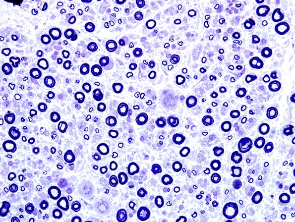 7A2 Stretch Artifact 60X.jpg