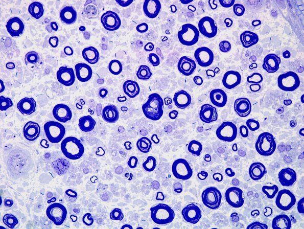 7A3 Artifact, stretch.jpg