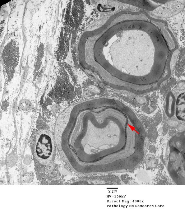 7A4 Artifact, myelin separation EM 003 copy - Copy