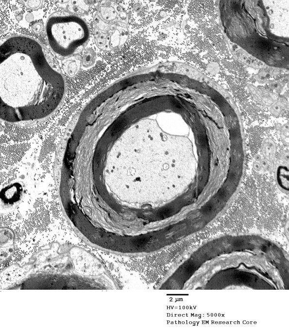 7A6 Artifact, myelin separation EM 073 - Copy
