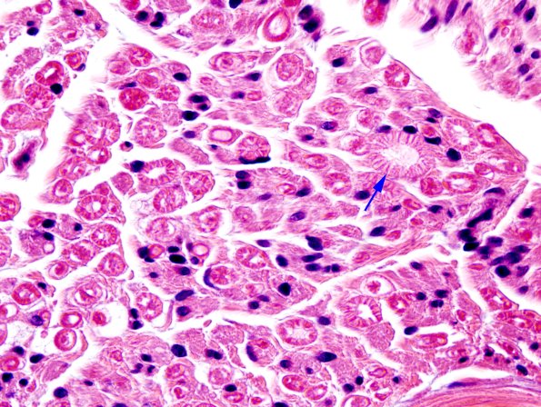 6A Normal sural nerve (Case 6) H&E 1