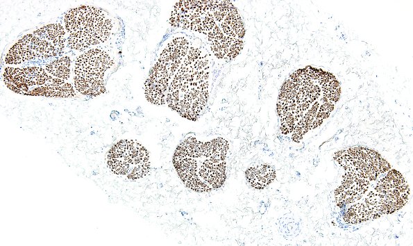 1A1 Axons, normal nerve (Case 1) Anti-NF 4