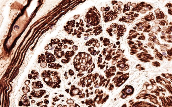 4A3 Nerve fibers (Case 4) Coll IV 100X