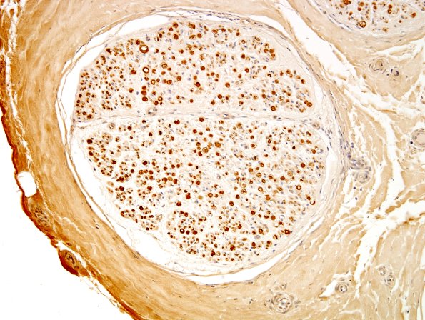 7A2 Nerve, normal Myelin Basic Protein (ts) 2