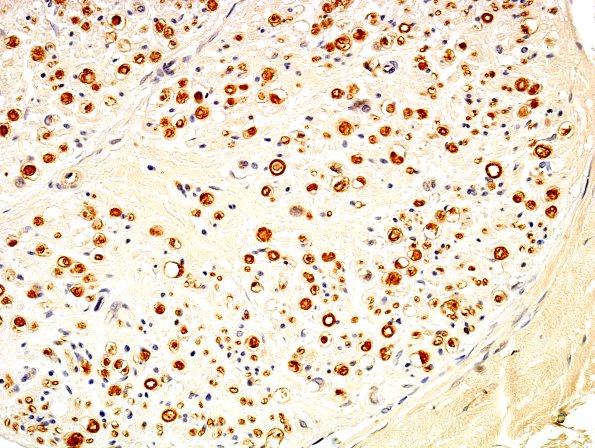7A3 Nerve, normal Myelin Basic Protein (ts) 1