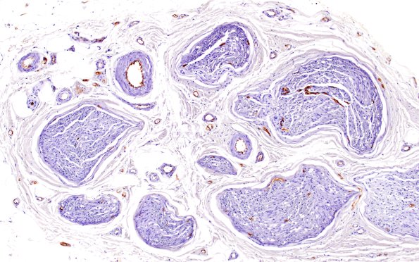 9A1 Ulex (Case 8) 10X 1