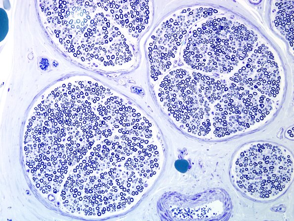 1A2 Normal Sural Nerve 20X Magnification series (Case 1).jpg