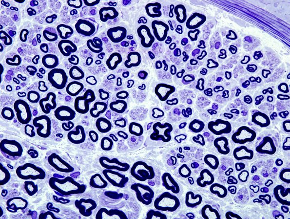 1A5 Normal Nerve (Case 1), 1000X,paranodal.jpg