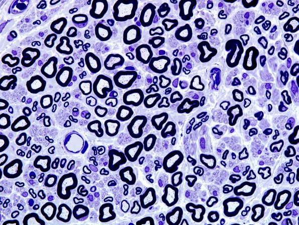 1A6 Normal Nerve (Case 1), 1000X, node, UMF, MF 2.jpg