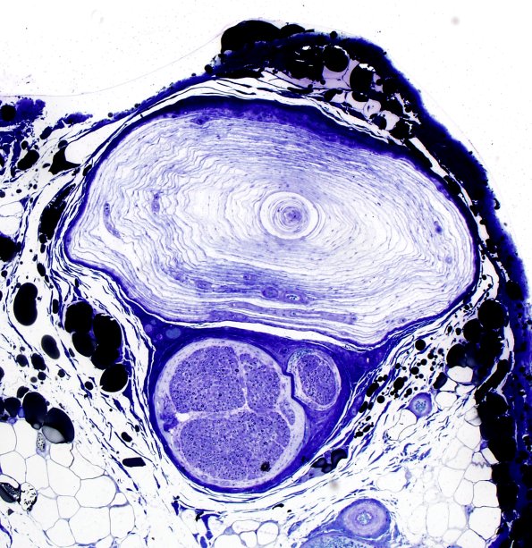 25A Pacinian (Case 25) Plastic 2.jpg