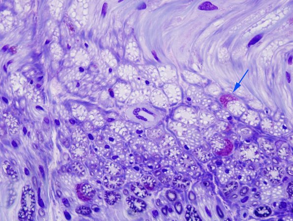 7A3 Nerve, normal (Case 7) Neurokeratin Plastic 11 copy