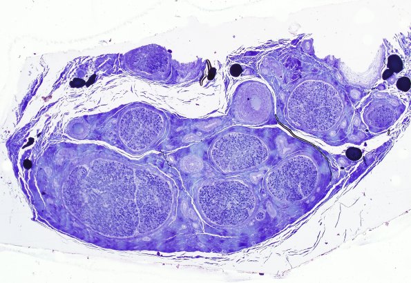 8A1 Normal sural nerve (Case 8) Plastic 4